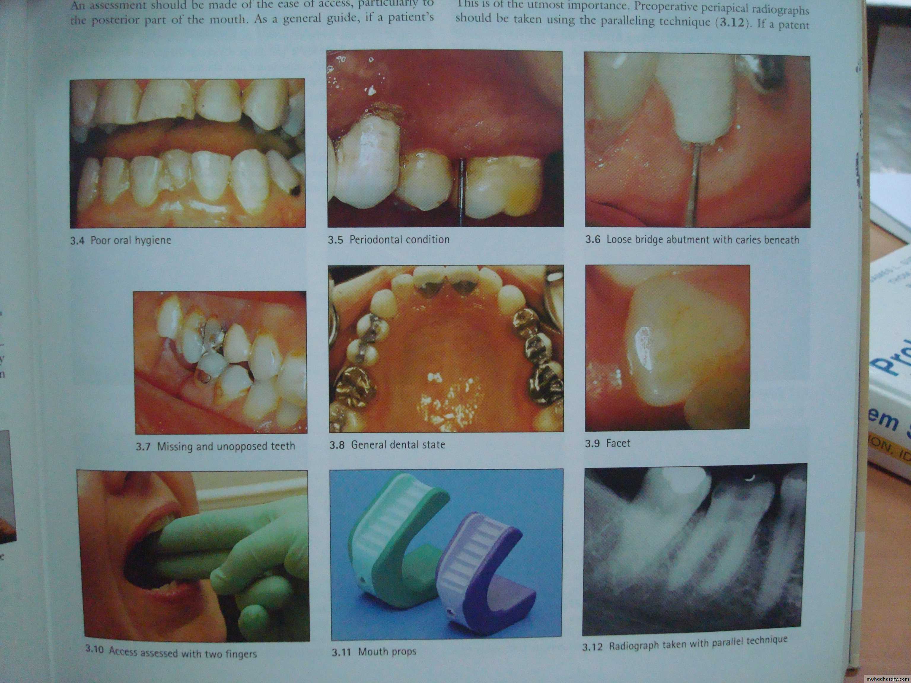 diagnostic procedures