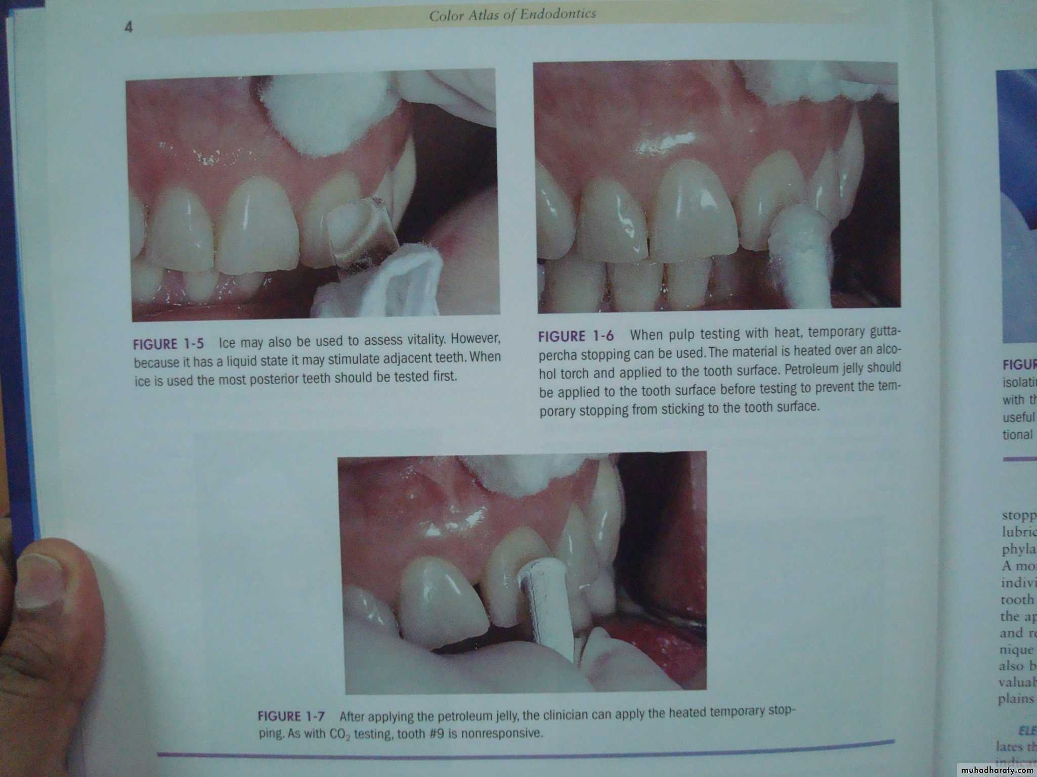 diagnostic procedures