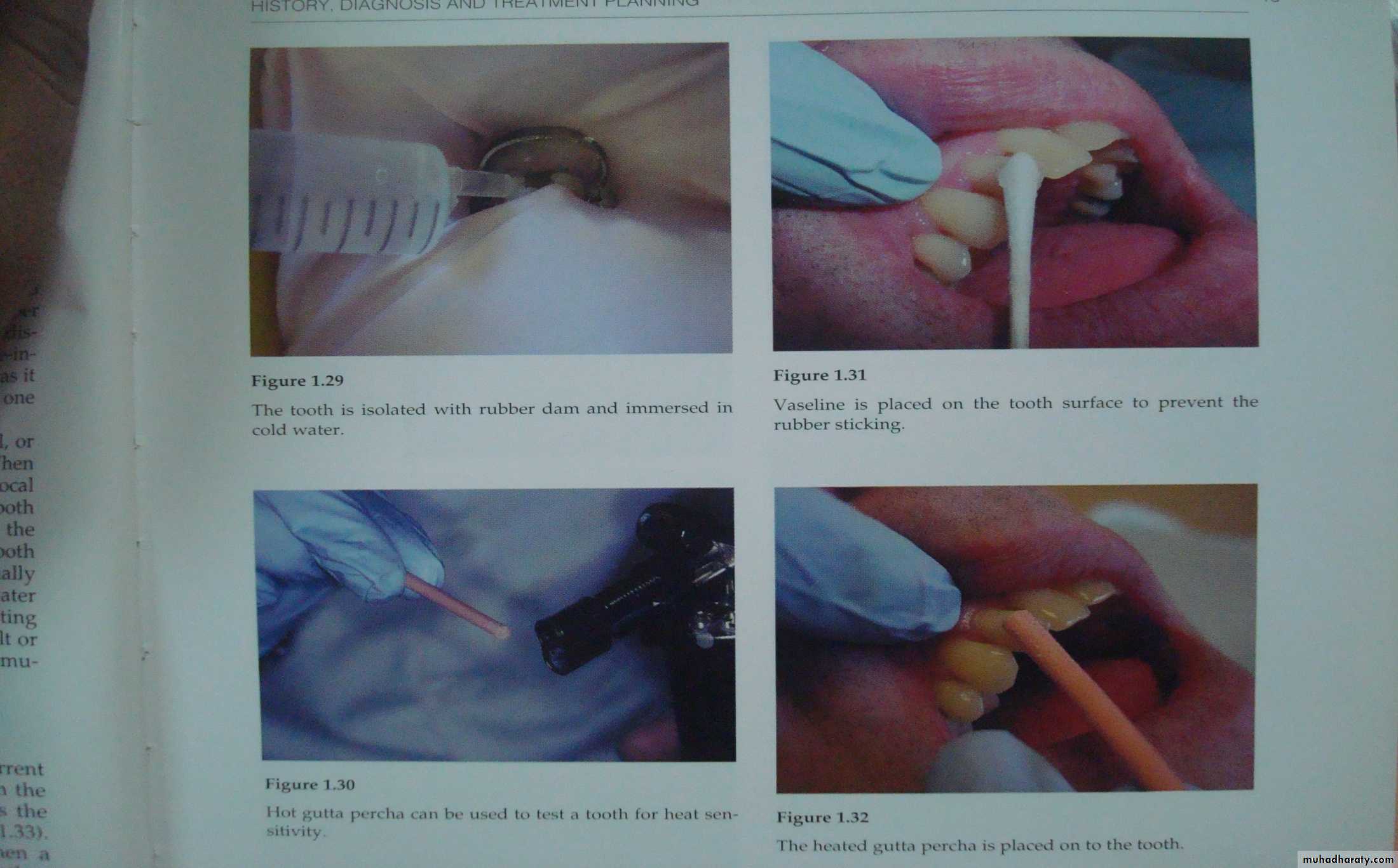 diagnostic procedures