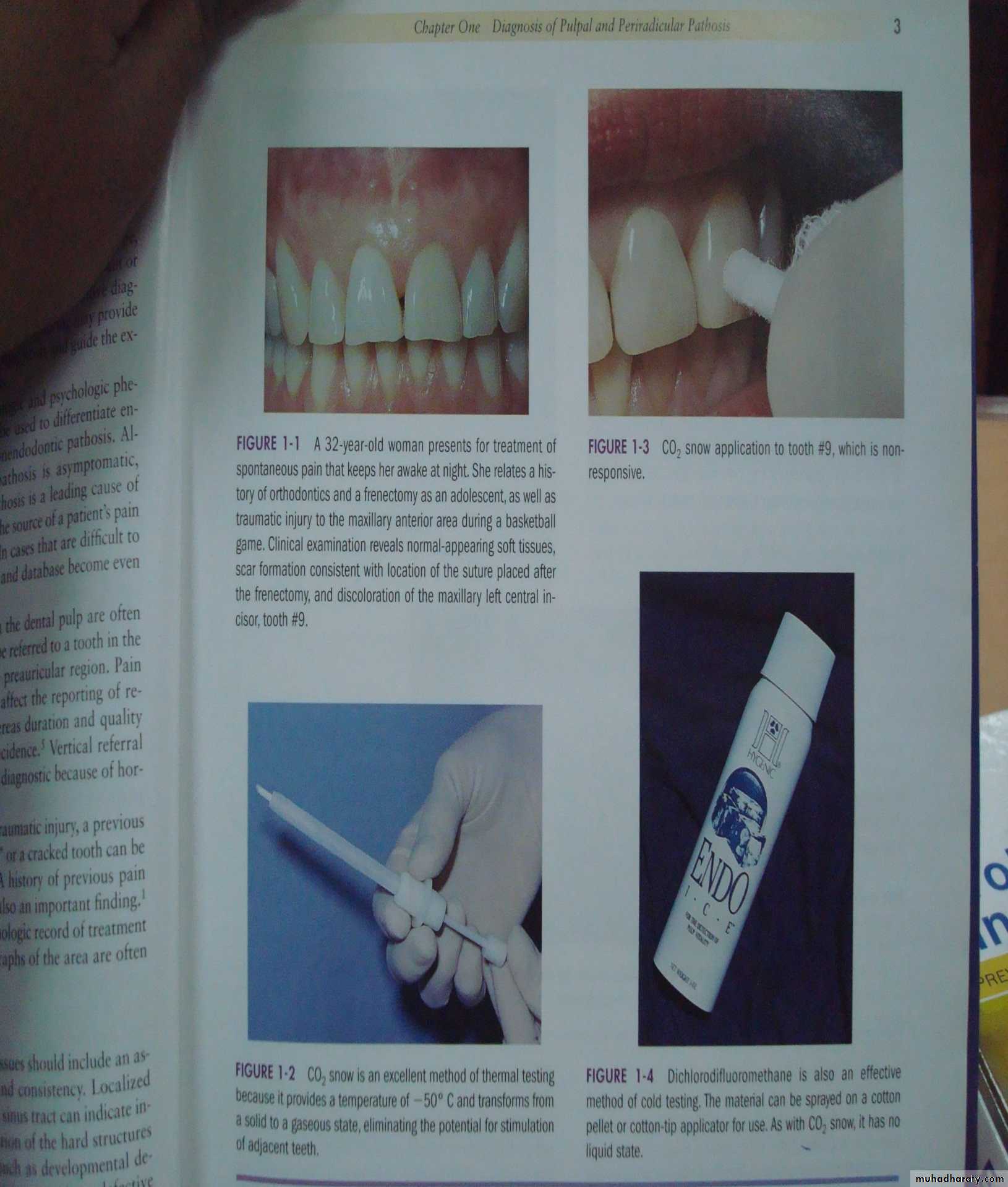 diagnostic procedures