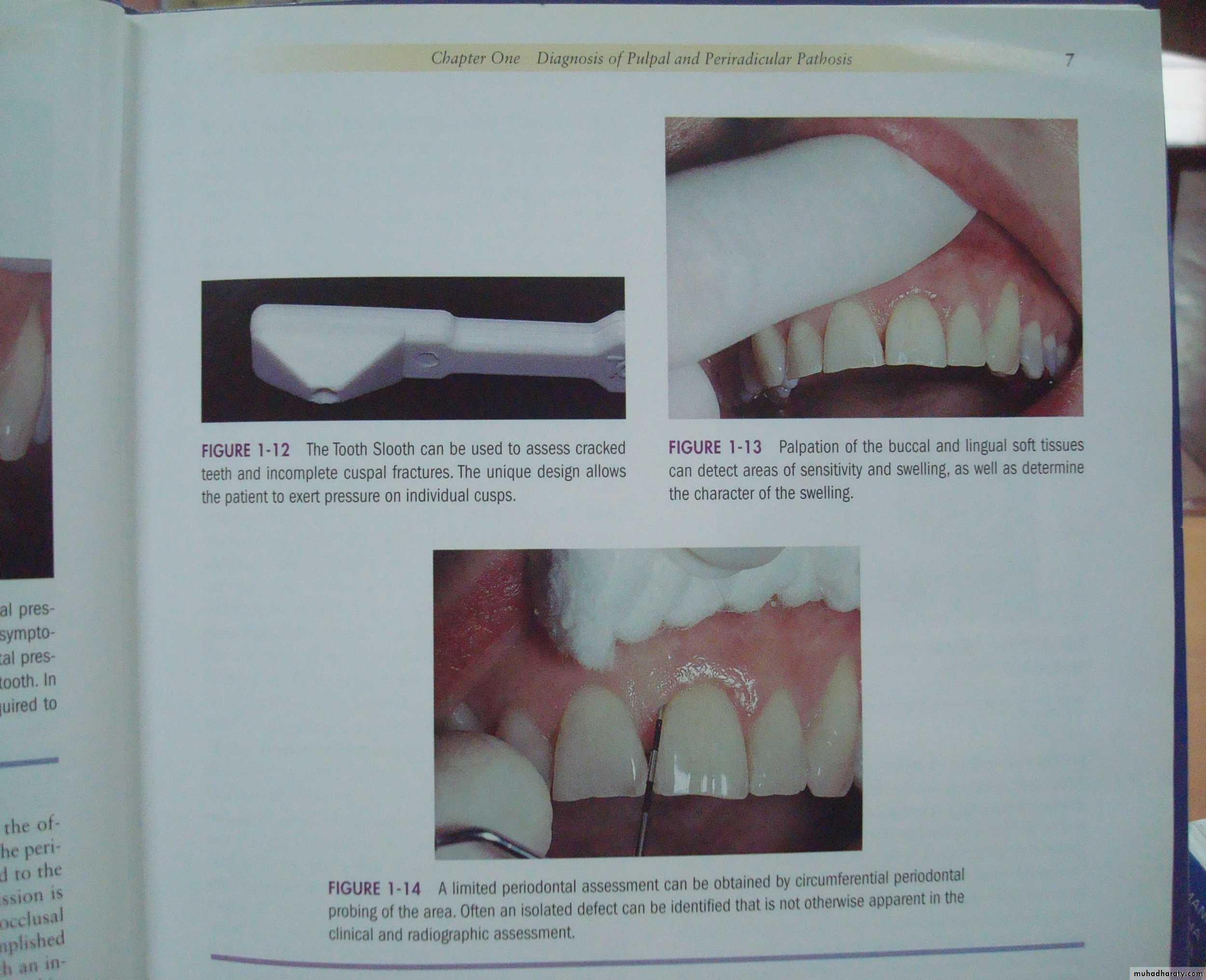 diagnostic procedures