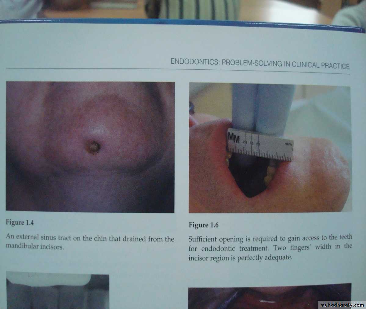 diagnostic procedures