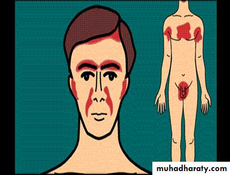 ENDOGENOUS ECZEMA