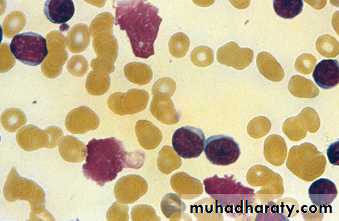 CLL