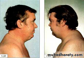 physical findings عملي