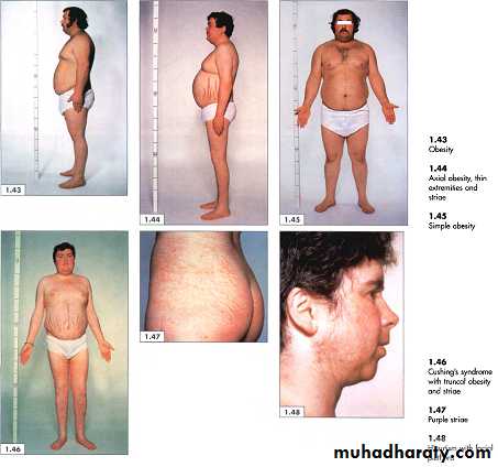 physical findings عملي