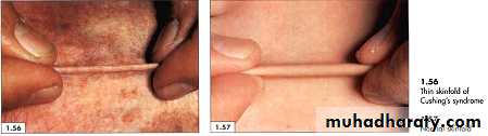 physical findings عملي