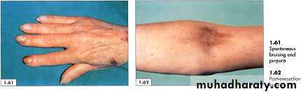 physical findings عملي