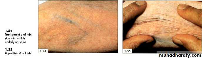 physical findings عملي