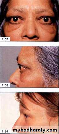 physical findings عملي