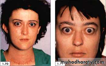 physical findings عملي