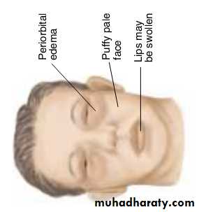 physical findings عملي