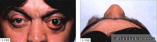 physical findings عملي