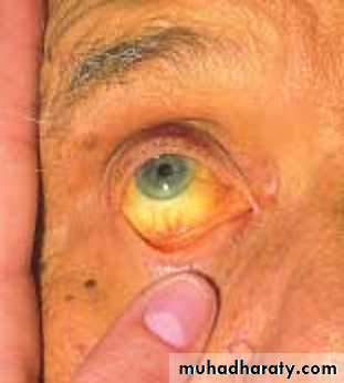 physical findings عملي