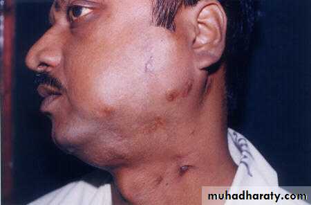 physical findings عملي