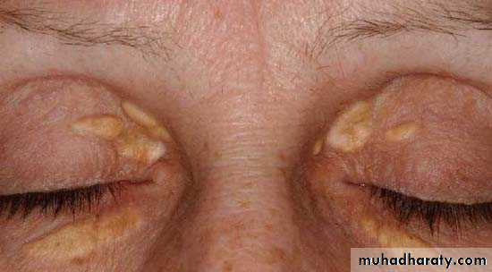 physical findings عملي