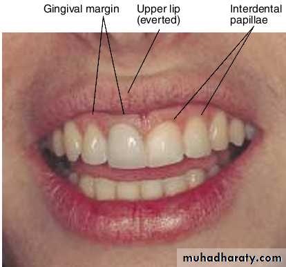 physical findings عملي