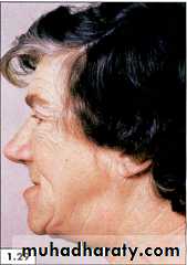 physical findings عملي