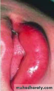 physical findings عملي
