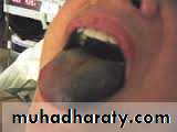 physical findings عملي