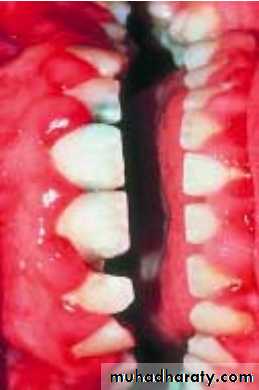 physical findings عملي