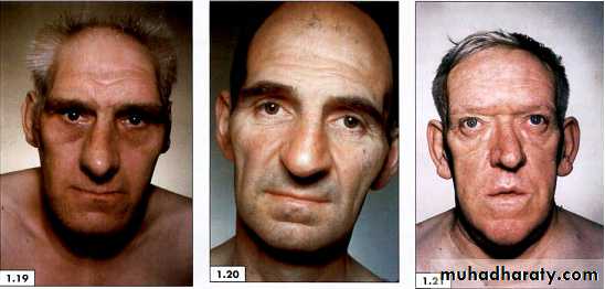physical findings عملي
