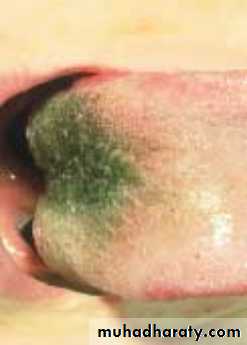 physical findings عملي