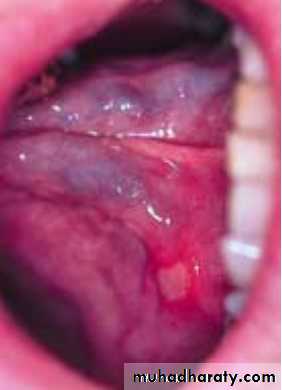 physical findings عملي