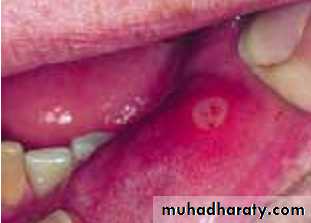 physical findings عملي