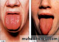 physical findings عملي
