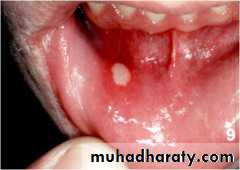 physical findings عملي