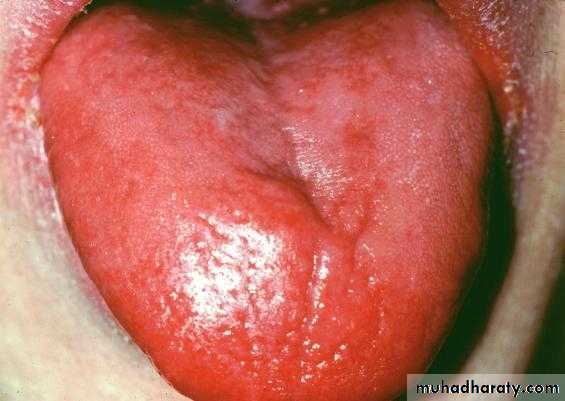 physical findings عملي