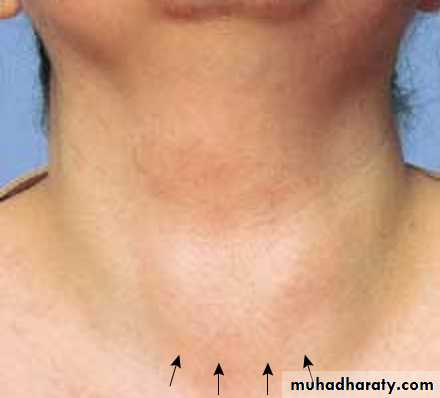 physical findings عملي