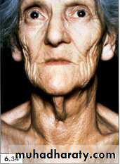 physical findings عملي
