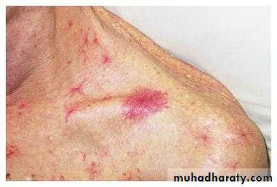 physical findings عملي