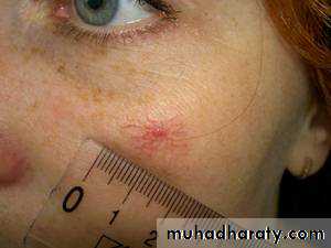 physical findings عملي