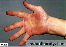 physical findings عملي