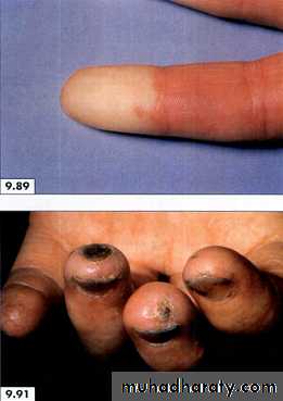 physical findings عملي