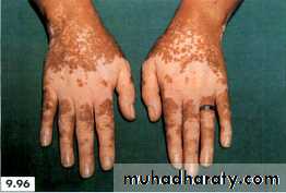 physical findings عملي