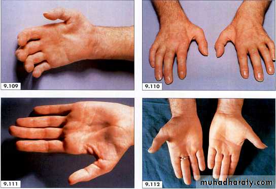 physical findings عملي