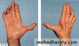 physical findings عملي