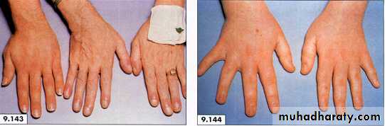 physical findings عملي