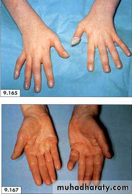 physical findings عملي