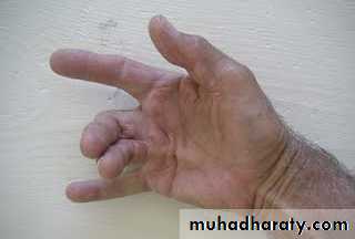 physical findings عملي
