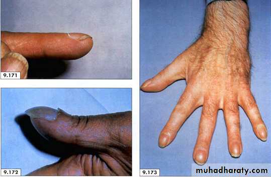 physical findings عملي