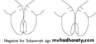 physical findings عملي