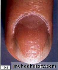 physical findings عملي