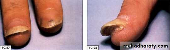 physical findings عملي