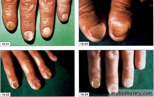 physical findings عملي