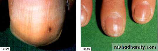 physical findings عملي